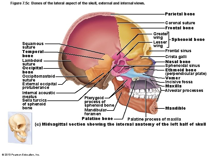 Figure 7. 5 c Bones of the lateral aspect of the skull, external and