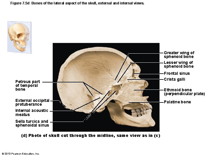 Figure 7. 5 d Bones of the lateral aspect of the skull, external and