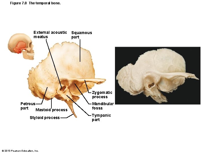 Figure 7. 8 The temporal bone. External acoustic meatus Squamous part Zygomatic process Petrous