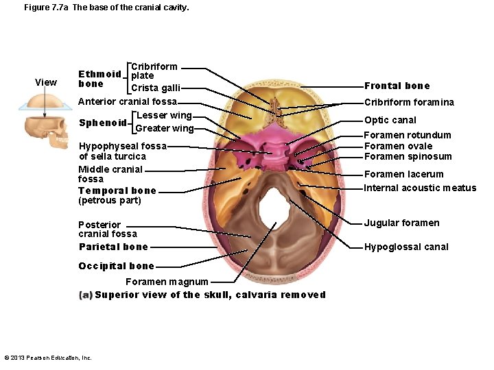 Figure 7. 7 a The base of the cranial cavity. View Cribriform Ethmoid plate