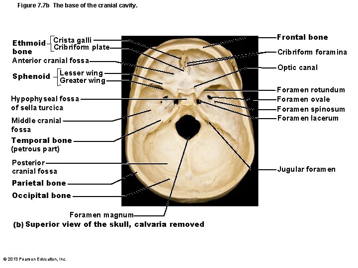 Figure 7. 7 b The base of the cranial cavity. Crista galli Cribriform plate