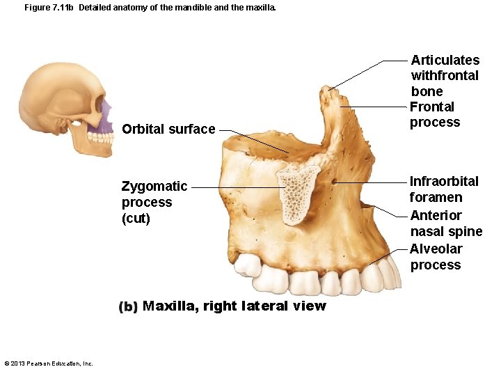 Figure 7. 11 b Detailed anatomy of the mandible and the maxilla. Orbital surface