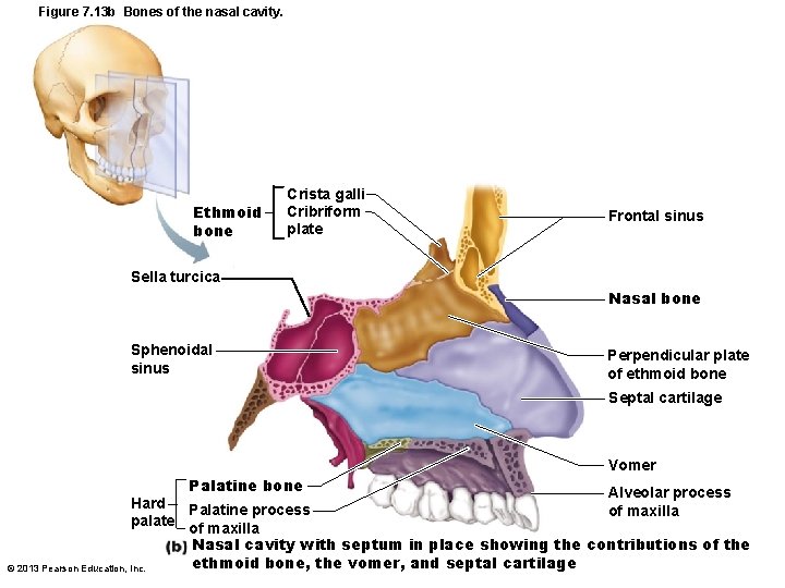 Figure 7. 13 b Bones of the nasal cavity. Ethmoid bone Crista galli Cribriform