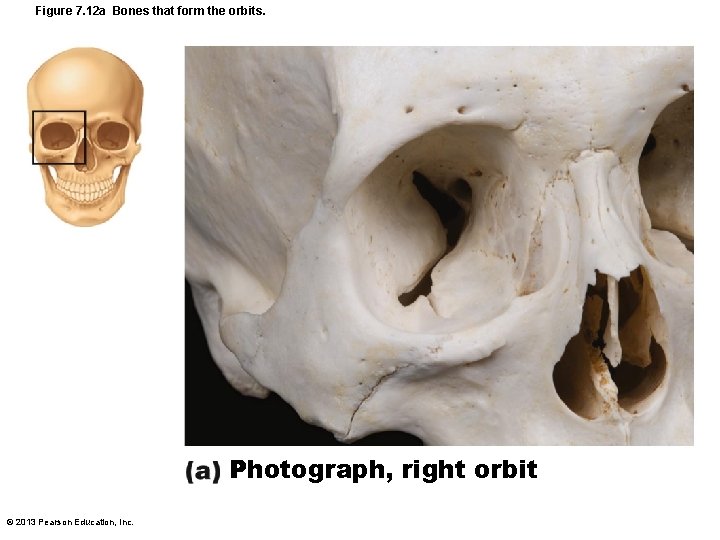 Figure 7. 12 a Bones that form the orbits. Photograph, right orbit © 2013