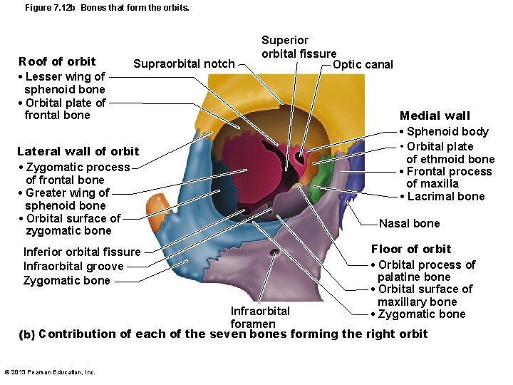 Figure 7. 12 b Bones that form the orbits. Roof of orbit • Lesser