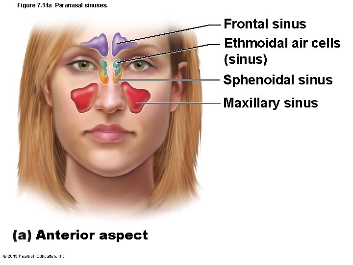 Figure 7. 14 a Paranasal sinuses. Frontal sinus Ethmoidal air cells (sinus) Sphenoidal sinus