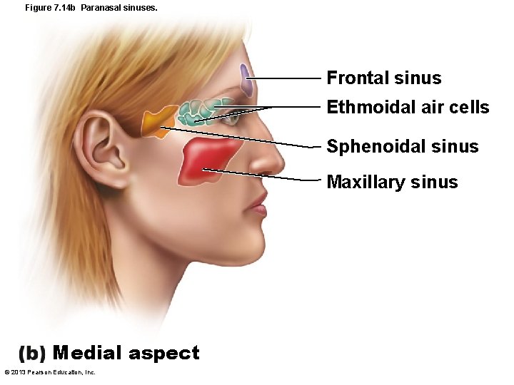 Figure 7. 14 b Paranasal sinuses. Frontal sinus Ethmoidal air cells Sphenoidal sinus Maxillary