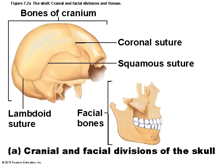 Figure 7. 2 a The skull: Cranial and facial divisions and fossae. Bones of