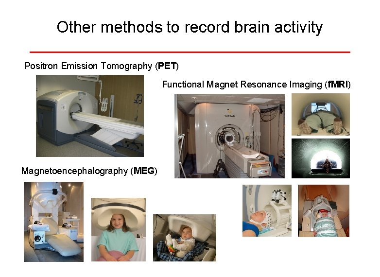 Other methods to record brain activity Positron Emission Tomography (PET) Functional Magnet Resonance Imaging