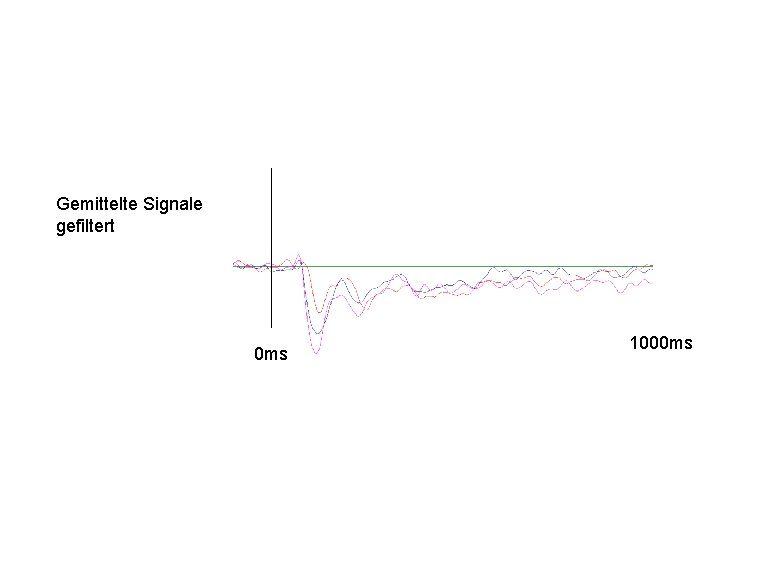 Gemittelte Signale gefiltert 0 ms 1000 ms 
