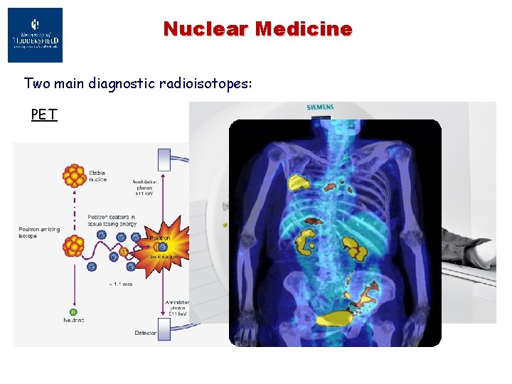 Nuclear Medicine Two main diagnostic radioisotopes: PET 