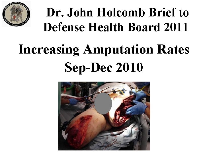 Dr. John Holcomb Brief to Defense Health Board 2011 Increasing Amputation Rates Sep-Dec 2010
