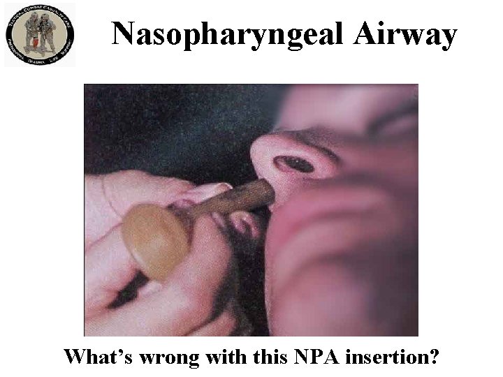 Nasopharyngeal Airway What’s wrong with this NPA insertion? 