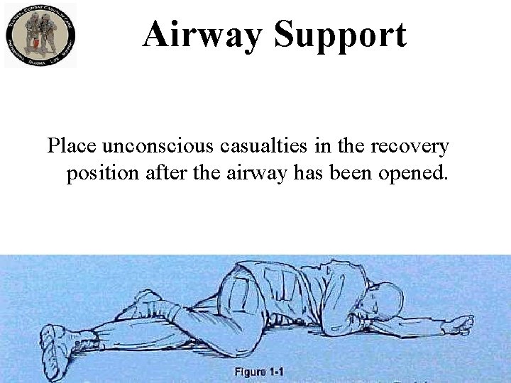 Airway Support Place unconscious casualties in the recovery position after the airway has been