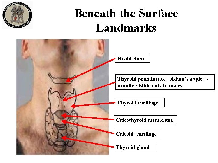 Beneath the Surface Landmarks Hyoid Bone Thyroid prominence (Adam’s apple ) usually visible only