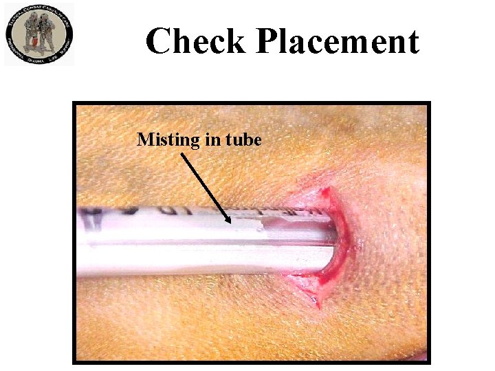 Check Placement Misting in tube 