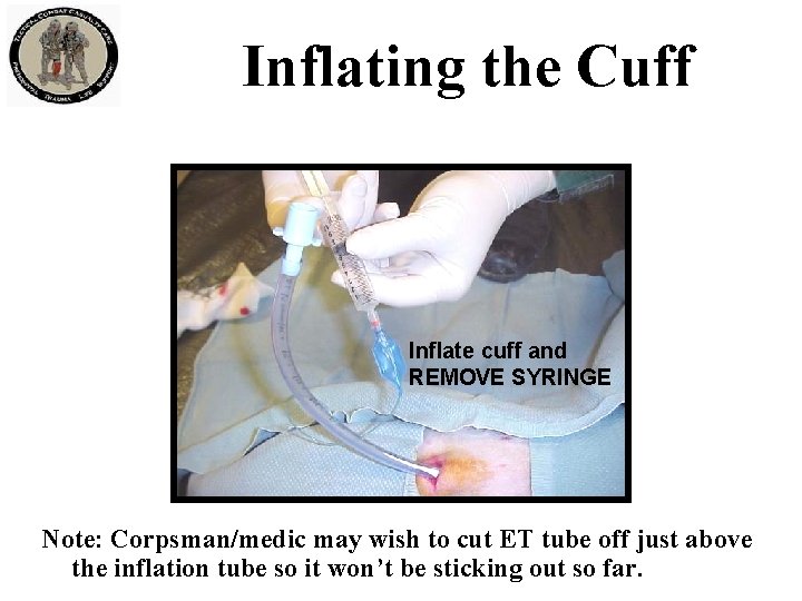 Inflating the Cuff Inflate cuff and REMOVE SYRINGE Note: Corpsman/medic may wish to cut