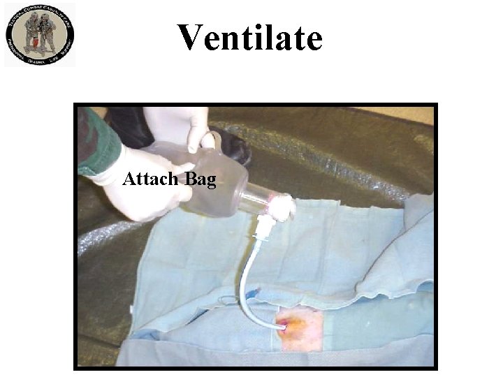 Ventilate Attach Bag 