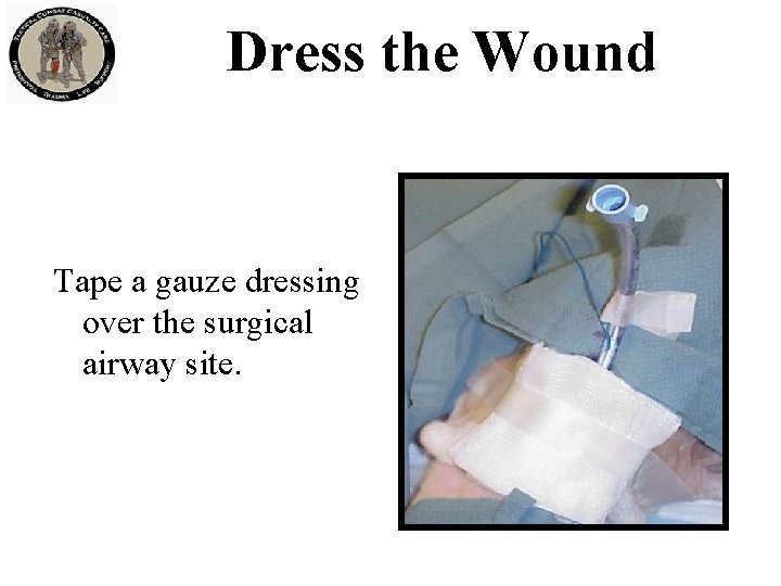 Dress the Wound Tape a gauze dressing over the surgical airway site. 