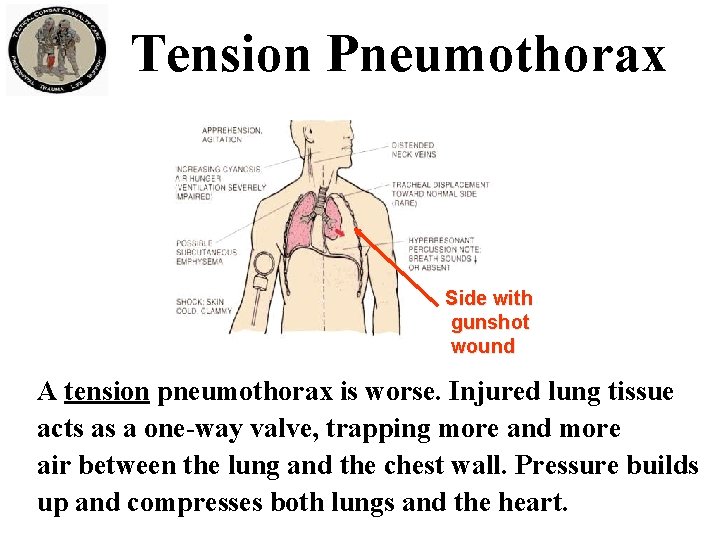 Tension Pneumothorax Side with gunshot wound A tension pneumothorax is worse. Injured lung tissue