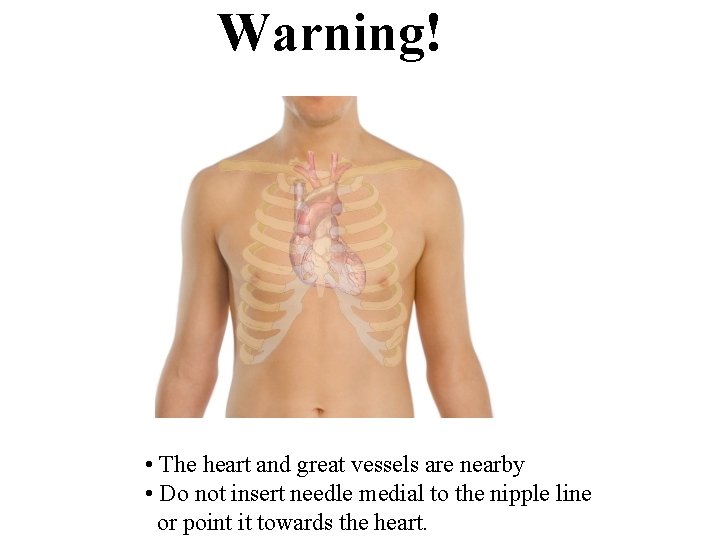 Warning! • The heart and great vessels are nearby • Do not insert needle