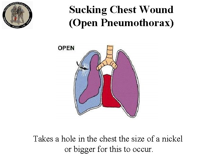 Sucking Chest Wound (Open Pneumothorax) Takes a hole in the chest the size of