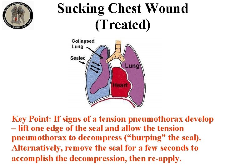 Sucking Chest Wound (Treated) Key Point: If signs of a tension pneumothorax develop –