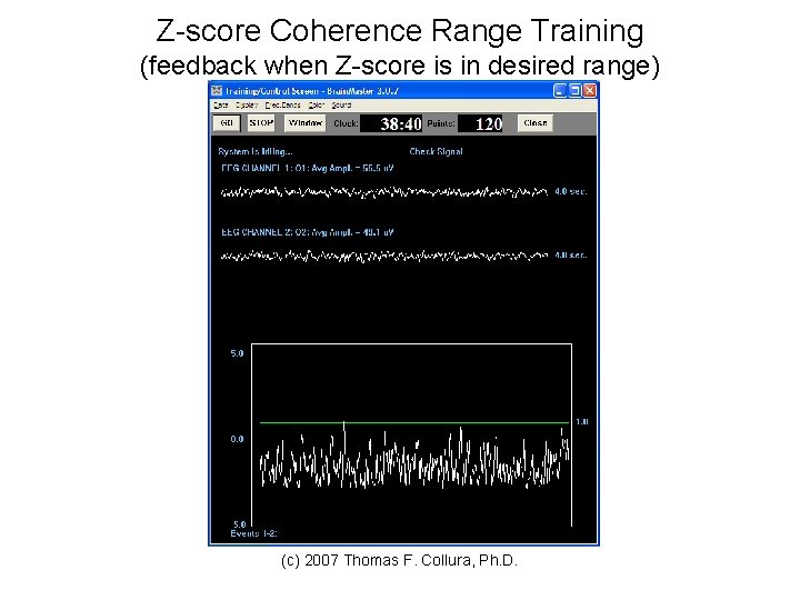 Z-score Coherence Range Training (feedback when Z-score is in desired range) (c) 2007 Thomas