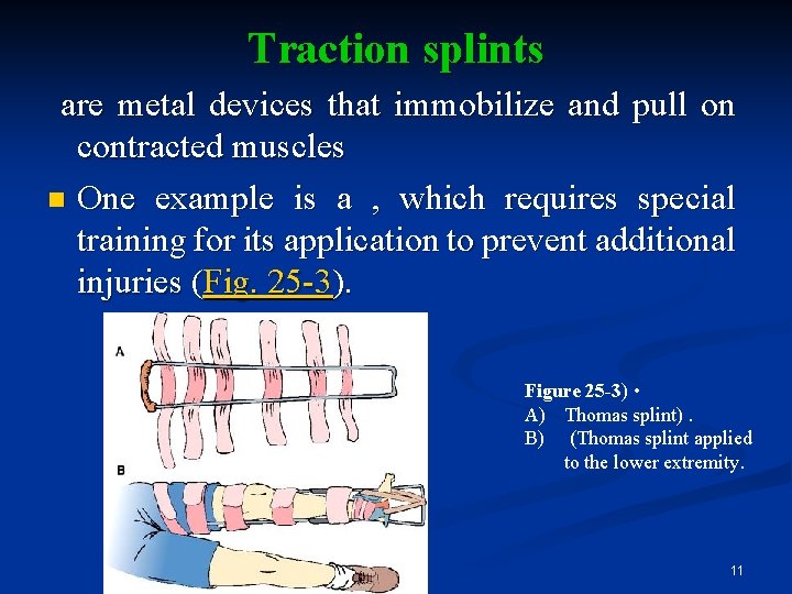 Traction splints are metal devices that immobilize and pull on contracted muscles n One