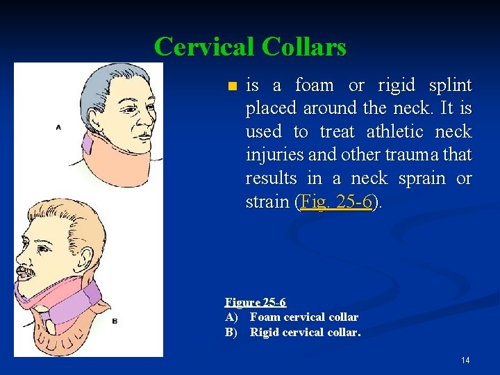 Cervical Collars n is a foam or rigid splint placed around the neck. It