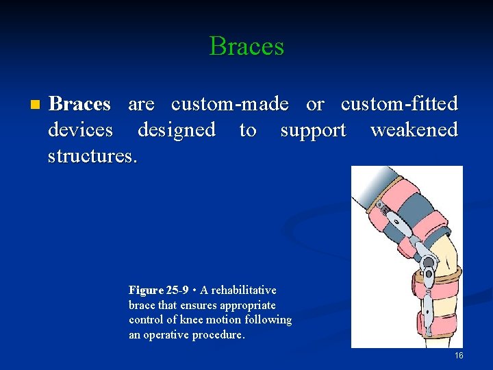 Braces n Braces are custom-made or custom-fitted devices designed to support weakened structures. Figure
