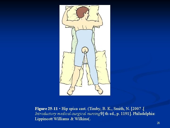 Figure 25 -11 • Hip spica cast. (Timby, B. K. , Smith, N. [2007.