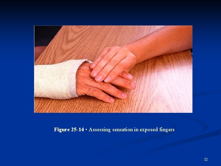 Figure 25 -14 • Assessing sensation in exposed fingers 32 