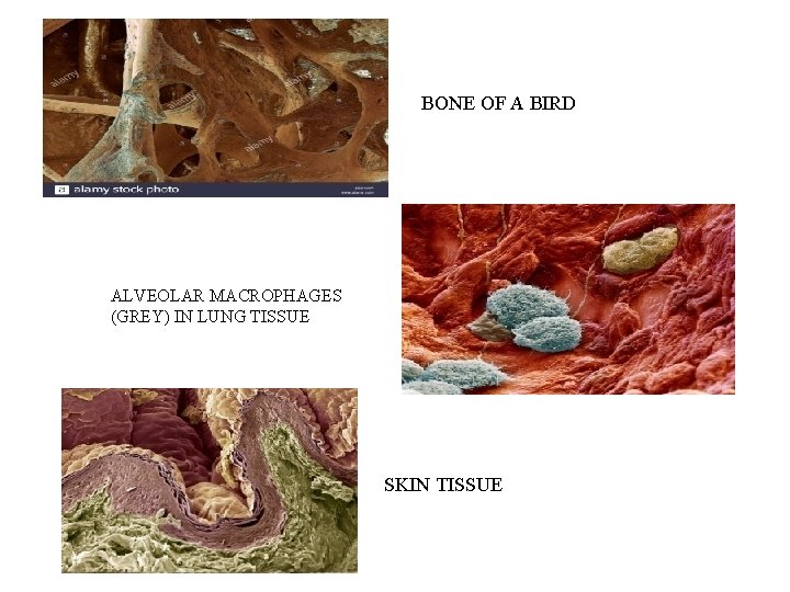 BONE OF A BIRD ALVEOLAR MACROPHAGES (GREY) IN LUNG TISSUE SKIN TISSUE 