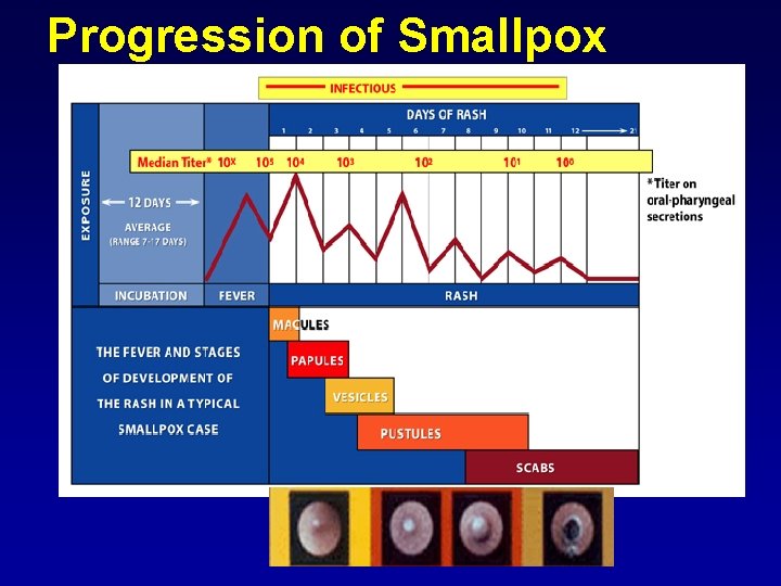 Progression of Smallpox 