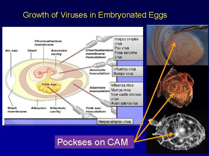 Growth of Viruses in Embryonated Eggs Pockses on CAM 