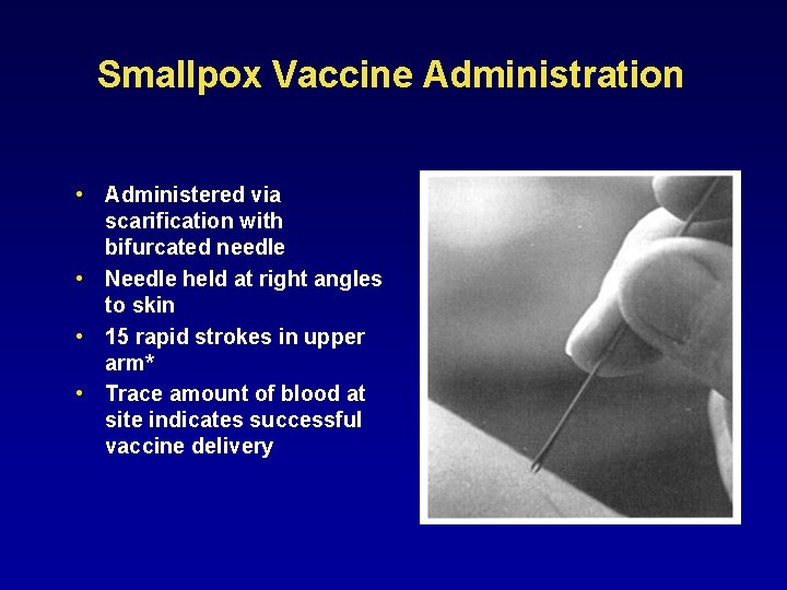 Smallpox Vaccine Administration • Administered via scarification with bifurcated needle • Needle held at