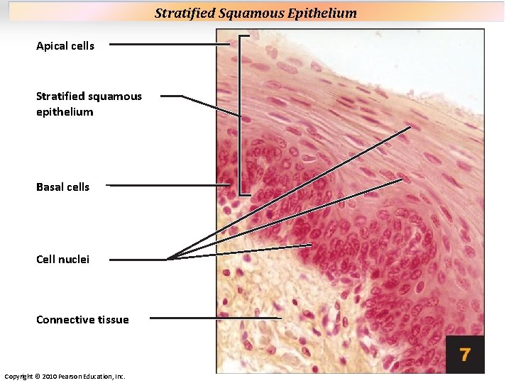 Plate 7 Apical cells Stratified squamous epithelium Basal cells Cell nuclei Connective tissue Copyright Plate 7 Apical cells Stratified squamous epithelium Basal cells Cell nuclei Connective tissue Copyright