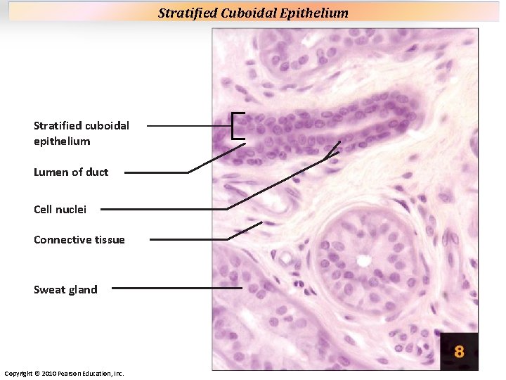 Plate 8 Stratified cuboidal epithelium Lumen of duct Cell nuclei Connective tissue Sweat gland Plate 8 Stratified cuboidal epithelium Lumen of duct Cell nuclei Connective tissue Sweat gland