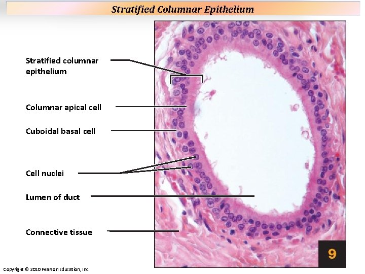 Plate 9 Stratified columnar epithelium Columnar apical cell Cuboidal basal cell Cell nuclei Lumen Plate 9 Stratified columnar epithelium Columnar apical cell Cuboidal basal cell Cell nuclei Lumen
