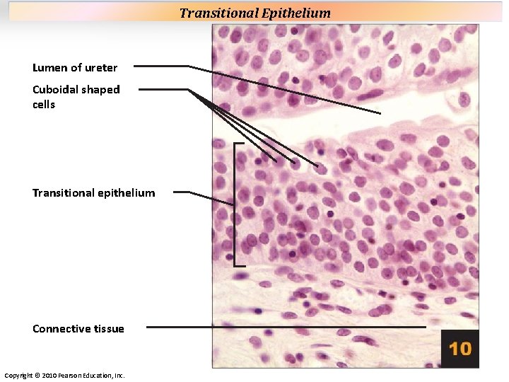 Plate 10 Lumen of ureter Cuboidal shaped cells Transitional epithelium Connective tissue Copyright © Plate 10 Lumen of ureter Cuboidal shaped cells Transitional epithelium Connective tissue Copyright ©
