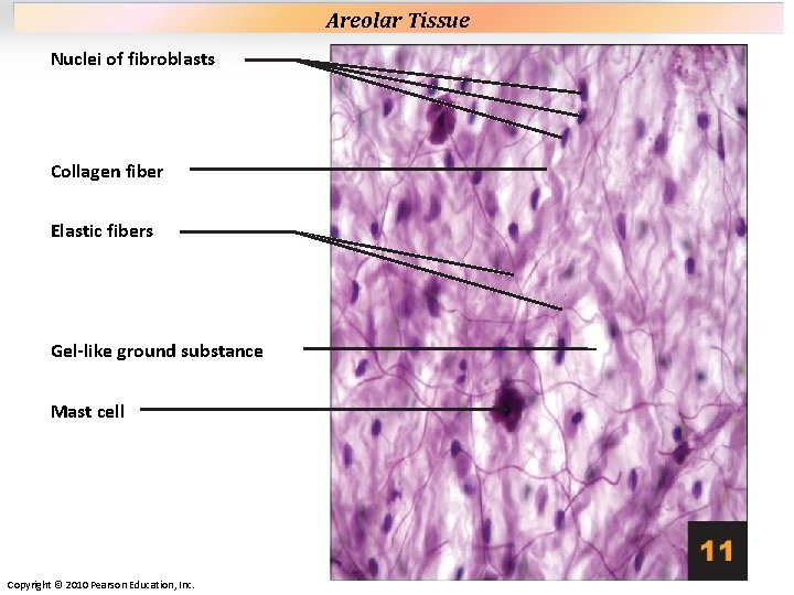 Plate 11 Nuclei of fibroblasts Collagen fiber Elastic fibers Gel-like ground substance Mast cell Plate 11 Nuclei of fibroblasts Collagen fiber Elastic fibers Gel-like ground substance Mast cell