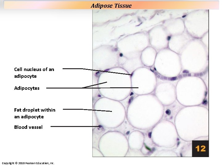 Plate 12 Cell nucleus of an adipocyte Adipocytes Fat droplet within an adipocyte Blood Plate 12 Cell nucleus of an adipocyte Adipocytes Fat droplet within an adipocyte Blood