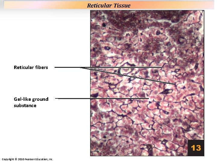 Plate 13 Reticular fibers Gel-like ground substance Copyright © 2010 Pearson Education, Inc. Reticular Plate 13 Reticular fibers Gel-like ground substance Copyright © 2010 Pearson Education, Inc. Reticular