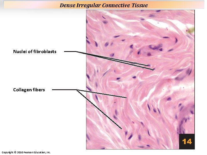 Plate 14 Nuclei of fibroblasts Collagen fibers Copyright © 2010 Pearson Education, Inc. Dense Plate 14 Nuclei of fibroblasts Collagen fibers Copyright © 2010 Pearson Education, Inc. Dense