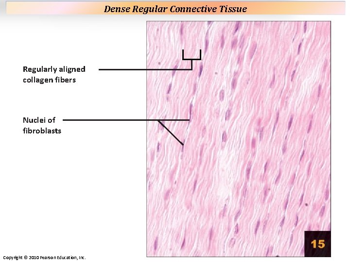 Plate 15 Regularly aligned collagen fibers Nuclei of fibroblasts Copyright © 2010 Pearson Education, Plate 15 Regularly aligned collagen fibers Nuclei of fibroblasts Copyright © 2010 Pearson Education,