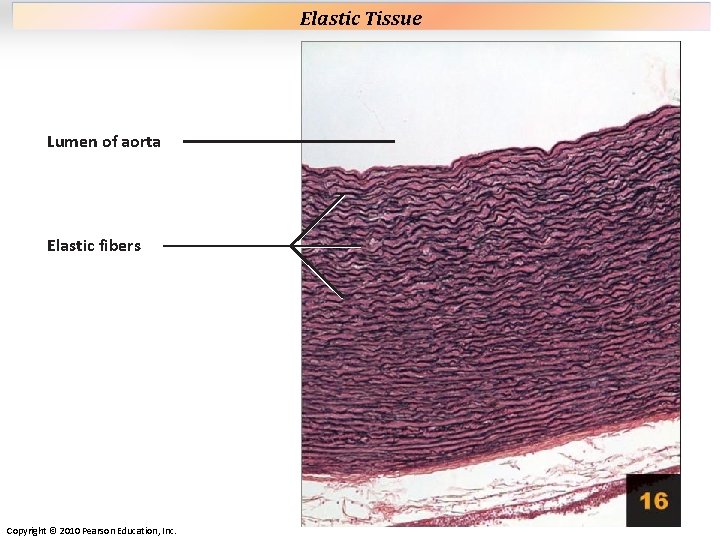 Plate 16 Lumen of aorta Elastic fibers Copyright © 2010 Pearson Education, Inc. Elastic Plate 16 Lumen of aorta Elastic fibers Copyright © 2010 Pearson Education, Inc. Elastic