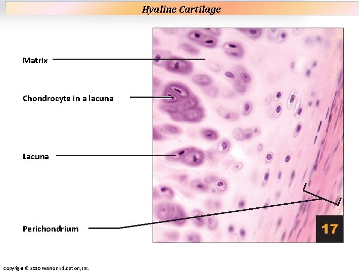 Plate 17 Matrix Chondrocyte in a lacuna Lacuna Perichondrium Copyright © 2010 Pearson Education, Plate 17 Matrix Chondrocyte in a lacuna Lacuna Perichondrium Copyright © 2010 Pearson Education,