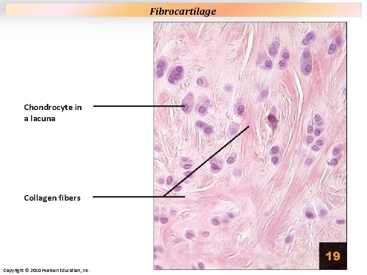 Plate 19 Chondrocyte in a lacuna Collagen fibers Copyright © 2010 Pearson Education, Inc. Plate 19 Chondrocyte in a lacuna Collagen fibers Copyright © 2010 Pearson Education, Inc.