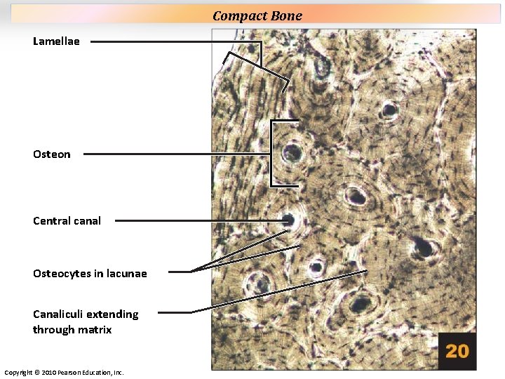 Plate 20 Lamellae Osteon Central canal Osteocytes in lacunae Canaliculi extending through matrix Copyright Plate 20 Lamellae Osteon Central canal Osteocytes in lacunae Canaliculi extending through matrix Copyright